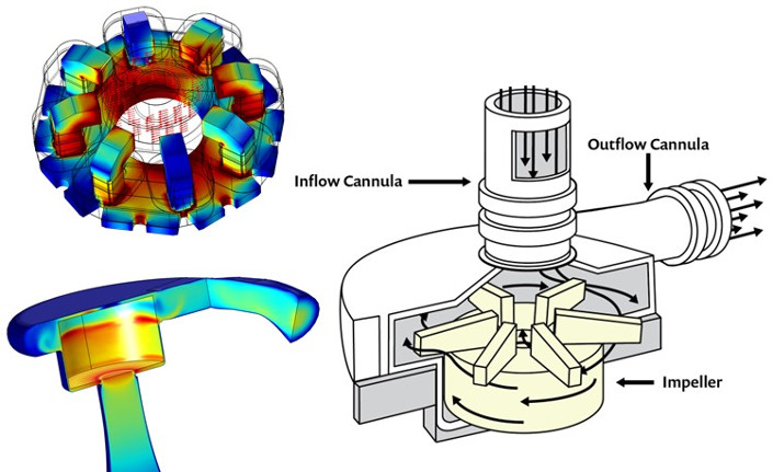 comsol ventricle assist