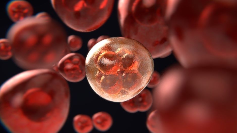 AI-based tool set to improve breast cancer diagnosis - Vimarsana News