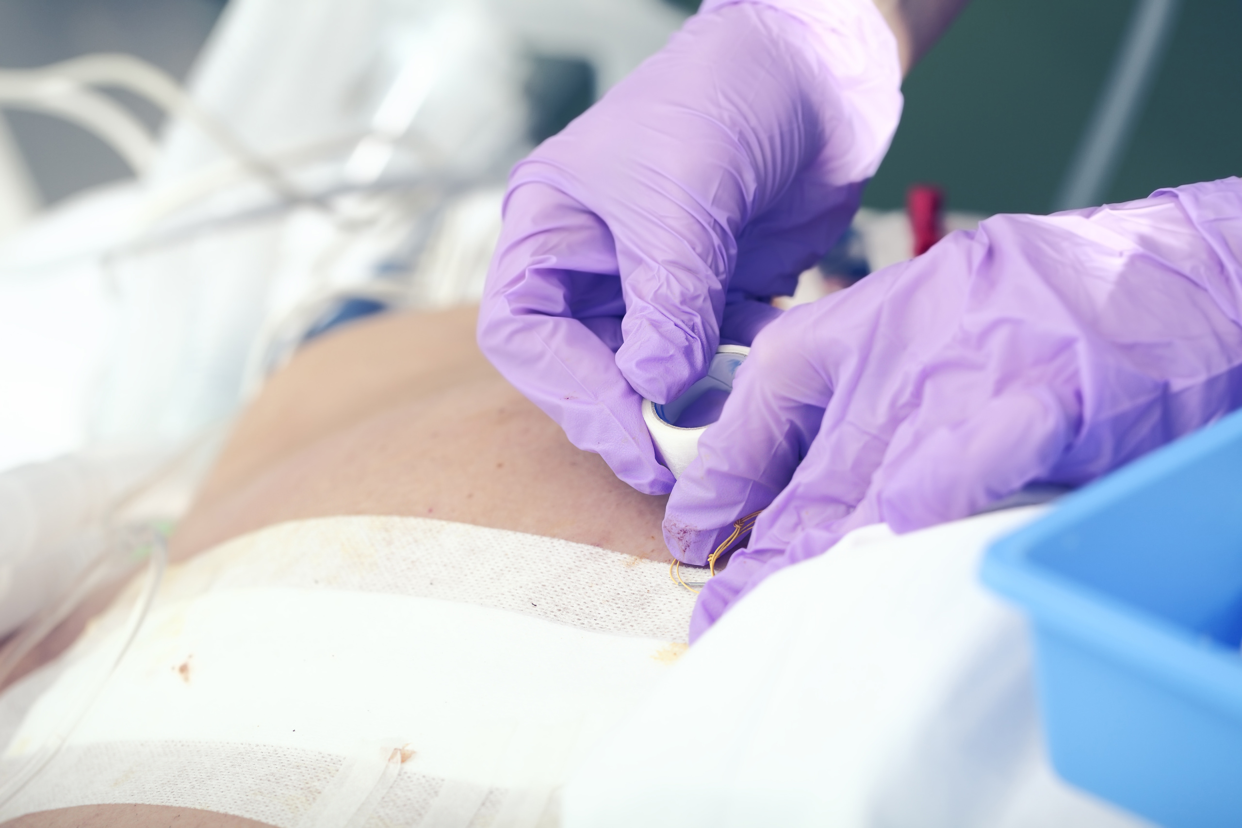 UK team develops printing technique for deep wound repair - Vimarsana News