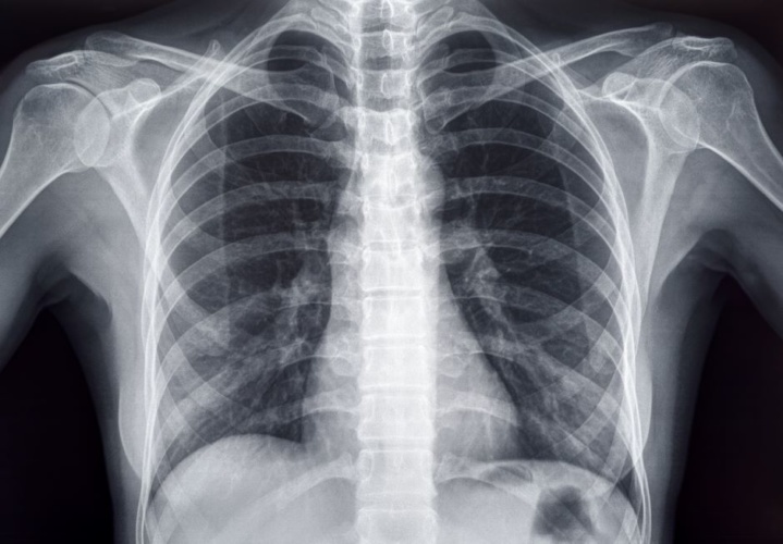 AI gives diagnosis of Covid-19 in 'a few minutes' | The Engineer The Engineer - Vimarsana News